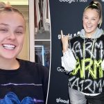 JoJo Siwa admits to spending $50K on cosmetic procedure