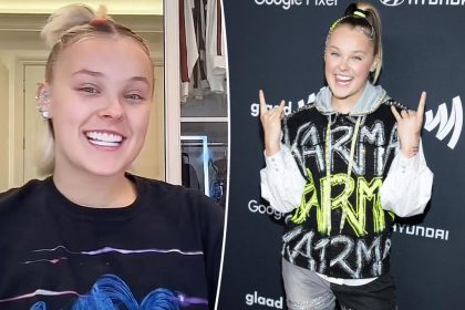 JoJo Siwa admits to spending $50K on cosmetic procedure