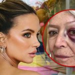 Kate Beckinsale Sparks Concern After Posting Photo of Mom with Bruised Eye