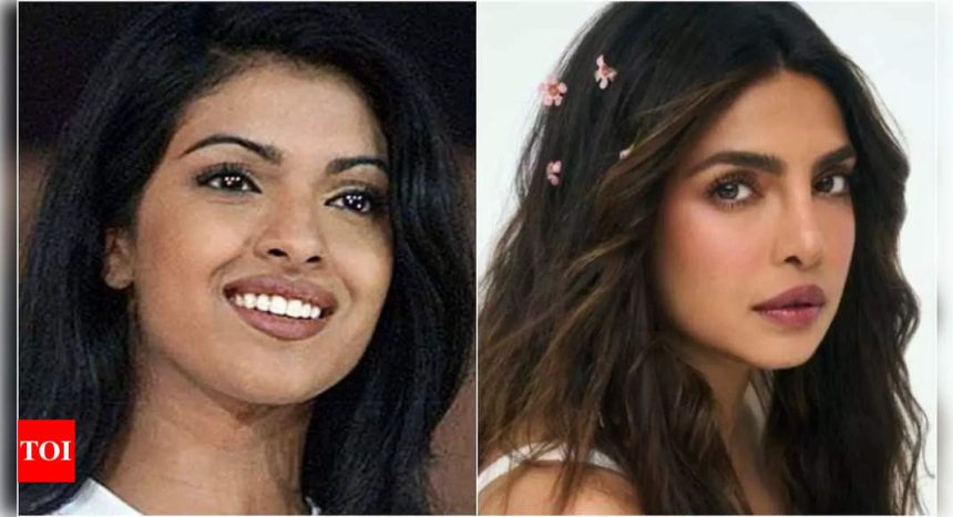 Surgery gone wrong: When Priyanka Chopra’s honest confession on her botched nose surgery reminded of its consequences | Hindi Movie News