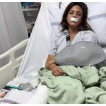 Shweta Rohira, Pulkit Samrat's first wife opens up about her accident; channels Shah Rukh Khan as she recovers from multiple fractures and injuries |